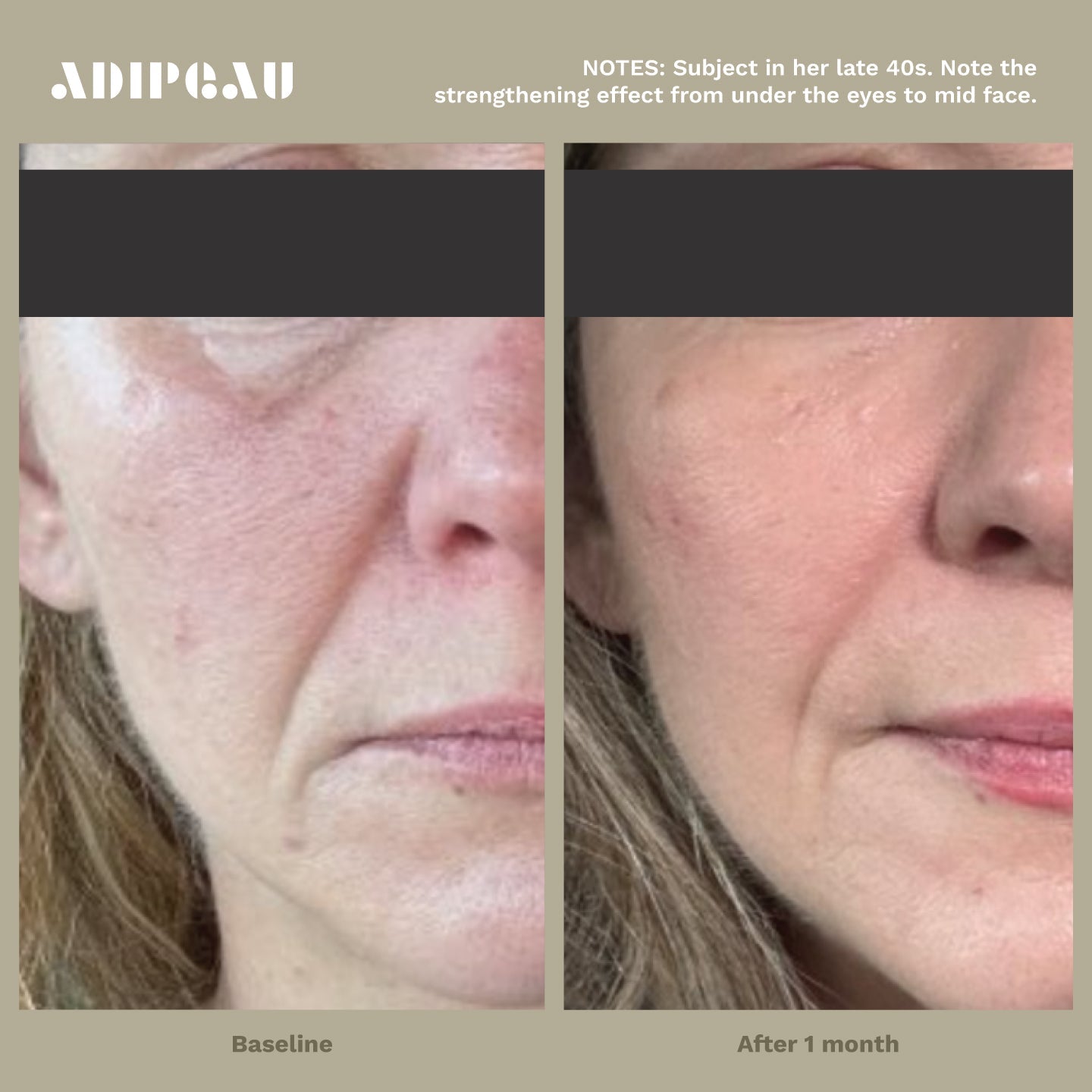 ADIPEAU Strong Body Gel