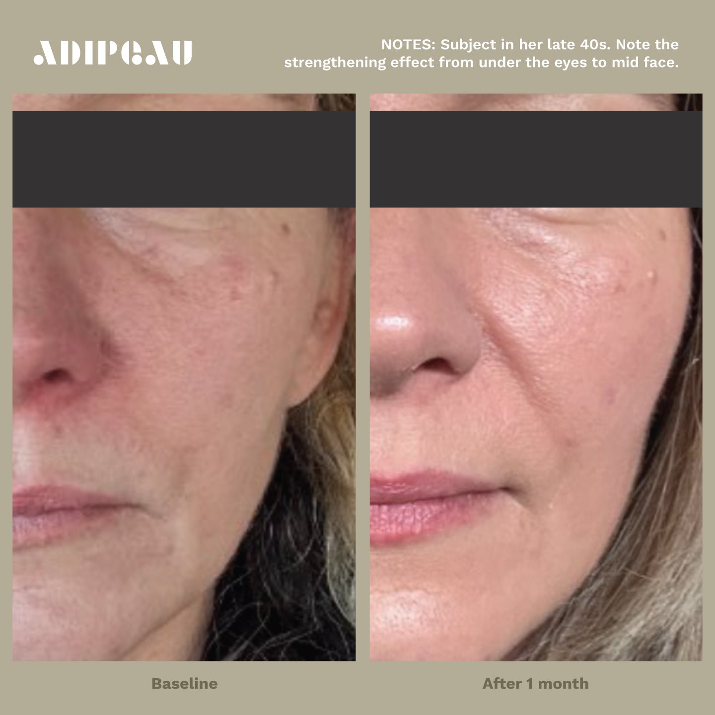 ADIPEAU Strong Body Gel
