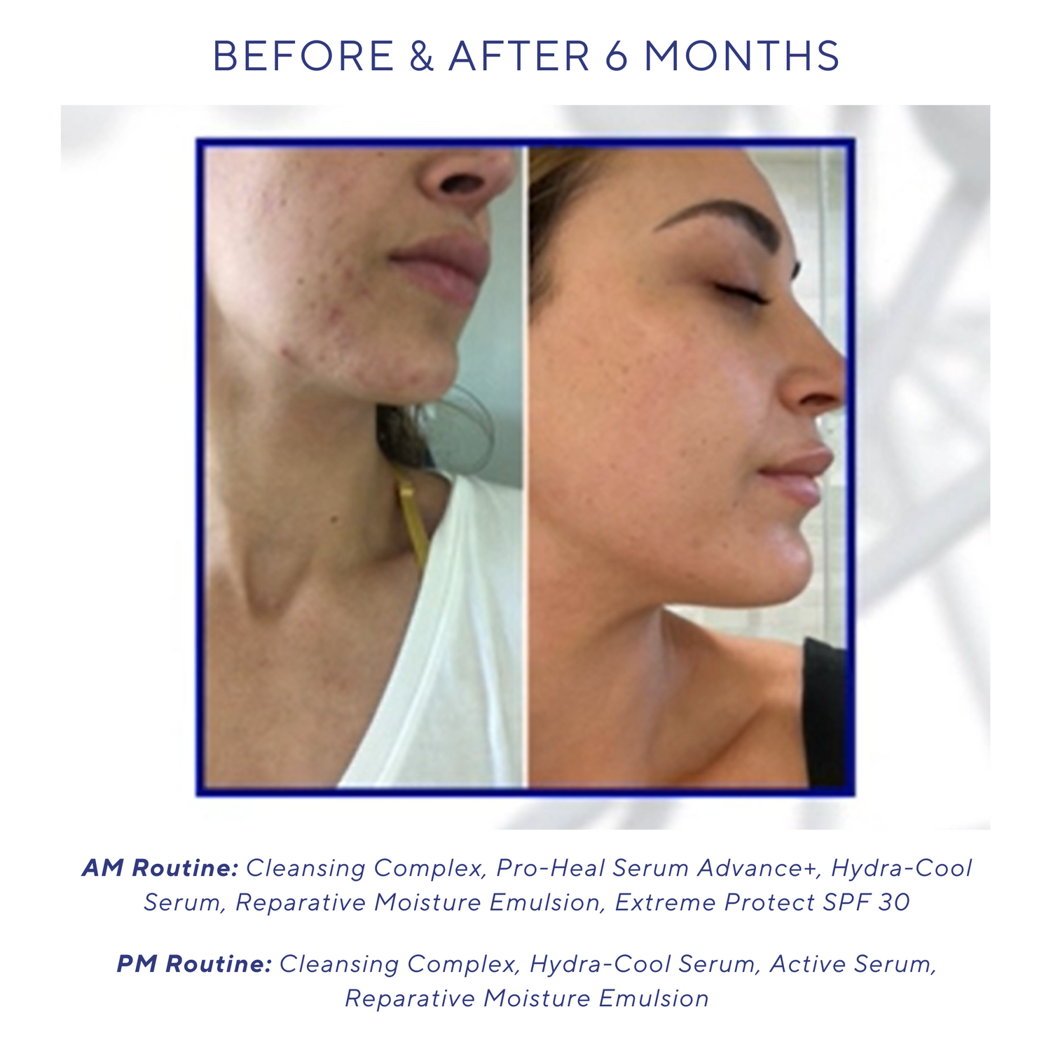 iS Clinical Cleansing Complex