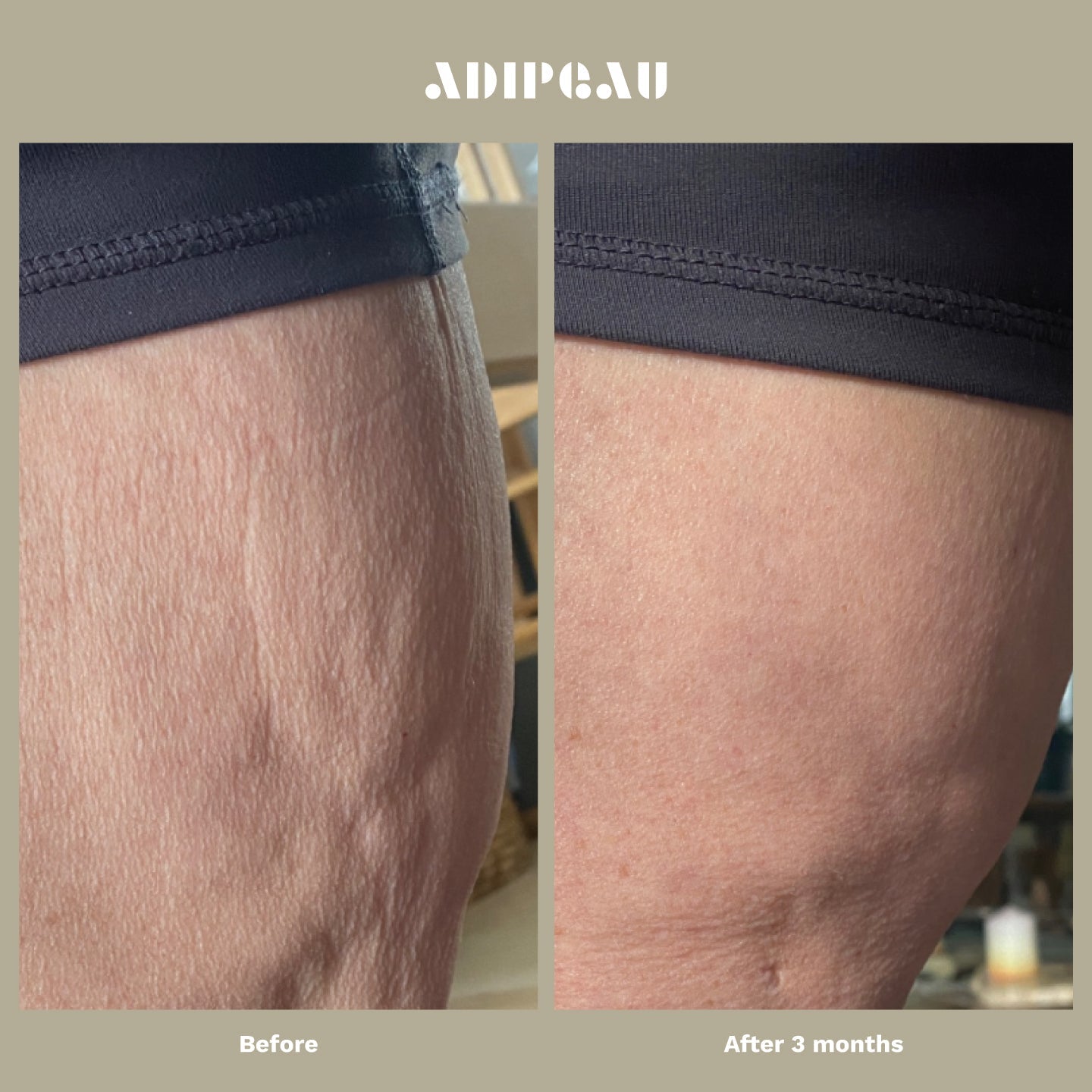 ADIPEAU Strong Body Gel