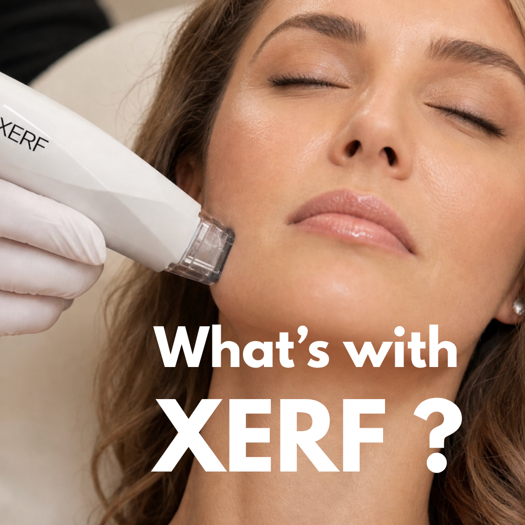 Amanda Holden, Nicole Scherzinger, Michelle Keegan and Barry Keoghan Try XERF at Dermaspa by Nilam Holmes
