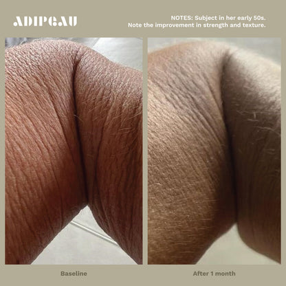 ADIPEAU Strong Body Gel