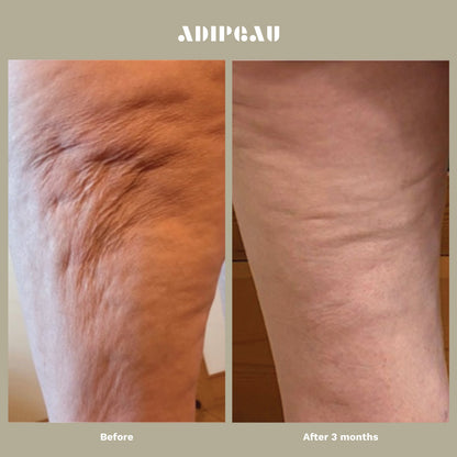 ADIPEAU Strong Body Gel